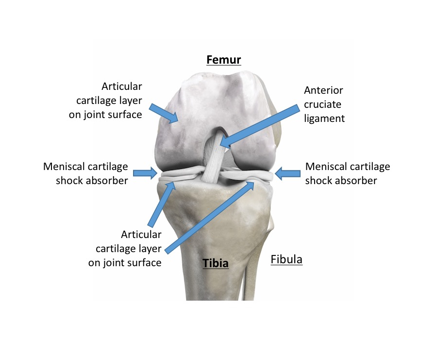 Knee Arthritis Knee Replacements In London